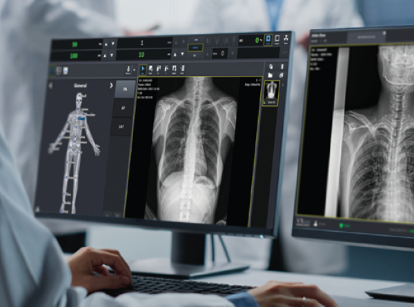 ▲뷰웍스 디지털 의료영상 획득 및 처리 소프트웨어 ‘브이엑스뷰(VXvue)’