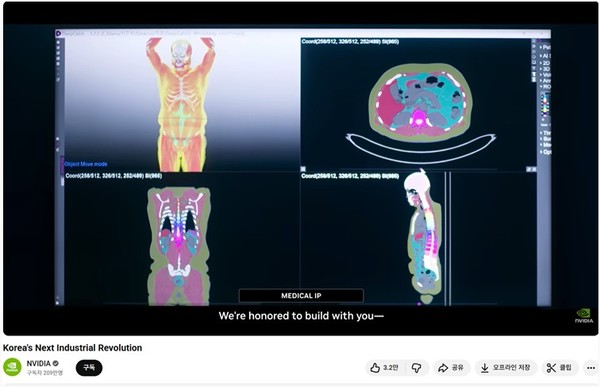 ▲엔비디아 공식 유튜브에서 공개된 메디컬아이피 딥캐치
